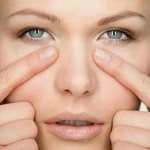 Причины отечности под глазами