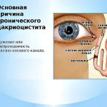 Причины развития заболевания