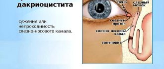 Причины развития заболевания