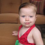 птоз верхнего века у ребенка фото