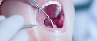 bubble in the mouth on the mucous membrane