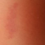 Пятно розового цвета