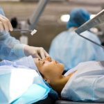 Радиальная кератотомия глаза