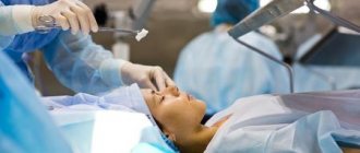 Radial keratotomy of the eye