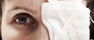 Роговица глаза