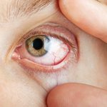 Symptoms of eye injury