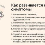 симптомы ячменя