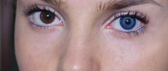 blue lenses for brown eyes