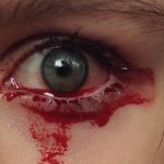 Blood is flowing from the eye