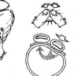 Тонометрия глаза по маклакову, норма