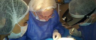 Трихиаз (неправильный рост ресниц на веке): причины патологии, симптомы, лечение