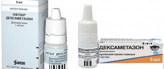 In ophthalmology, medications for instillation into the eyes of Dexamethasone or Oftan Dexamethasone are widely used.