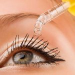 Varicose veins of the eye