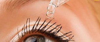 Варикоз вен глаза