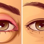 Воспалительный отек.jpg