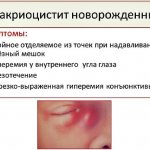 Закупорка слезного канала у новорожденных. Симптомы непроходимости, массаж, народные средства, лечение лазером, операция