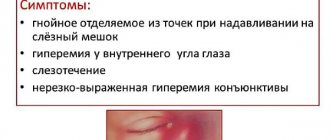 Blockage of the tear duct in newborns. Symptoms of obstruction, massage, folk remedies, laser treatment, surgery
