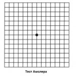 A healthy person sees the Amsler table like this: